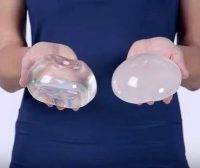 Which Breast Implants Are The Best