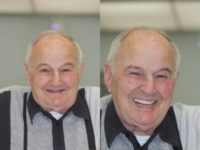 75 and up year old man treated with All-on-4 Dental Implants