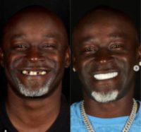 Man treated with Smile Makeover